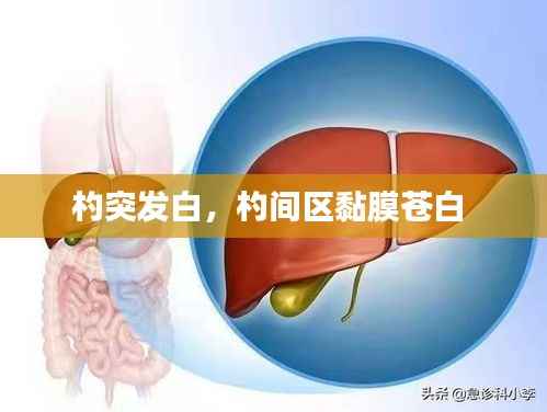 杓突发白,杓间区黏膜苍白