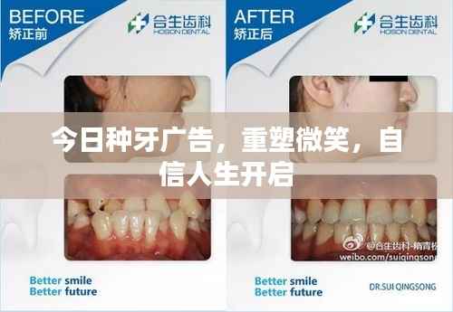 今日种牙广告,重塑微笑,自信人生开启