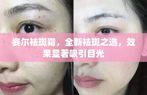 姿尔祛斑霜,全新祛斑之选,效果显著吸引目光